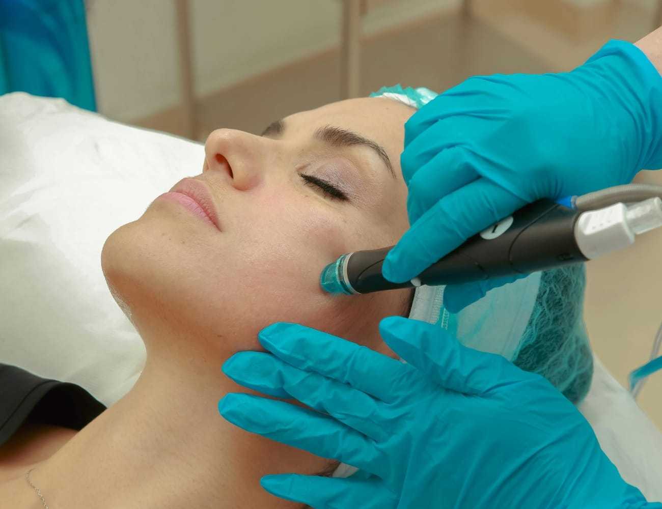 Facial treatment with a hydra-dermabrasion device on a woman's cheek by a professional.